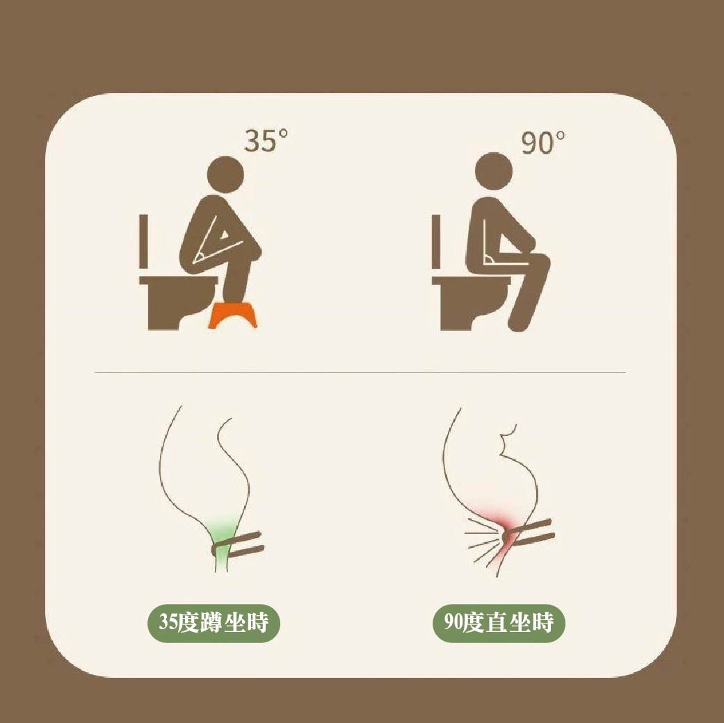 馬桶腳踏凳 家用加厚 廁所蹲坑神器 成人兒童腳墊凳 坐便凳 孕婦腳踏 腳踩凳  助便椅 加厚防滑 浴室椅 可愛圖案